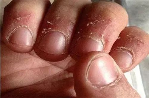 啃指甲,吃手,咬铅笔孩子小动作背后暗藏心理问题