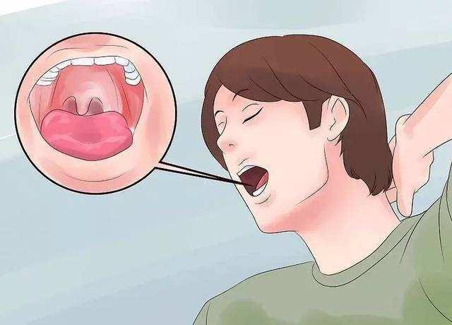 脑梗不会悄无声息,一旦头部出现5种特征,快去