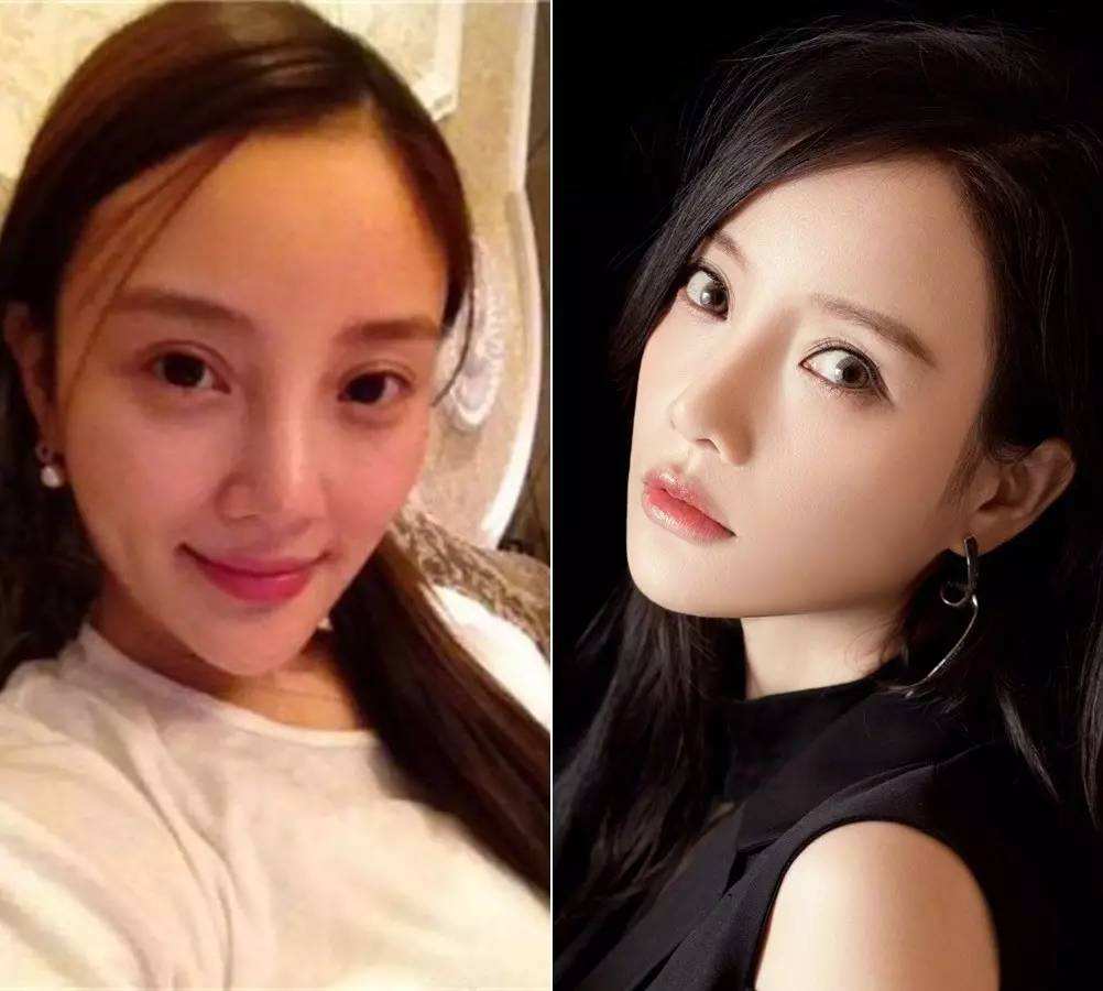 23岁网红过度整容,身材比例失调,直言"青春饭吃不了几年"