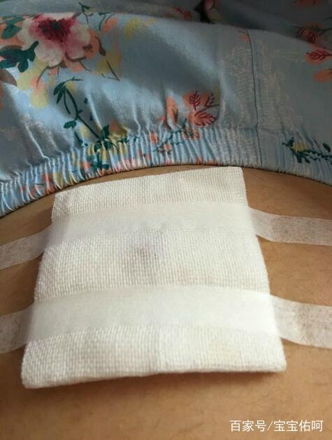 羊水穿刺前后注意哪些事,一般医生会一句话带过,孕妈别发慌