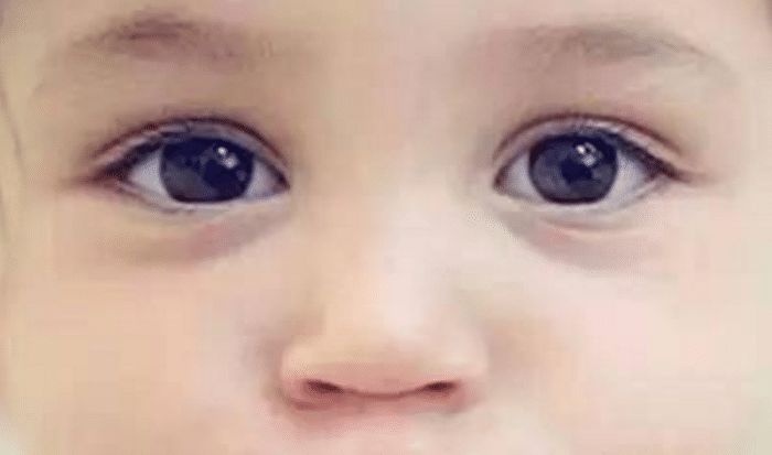 孩子的五官一般遗传自己的父亲, 所以父亲的颜值是关键