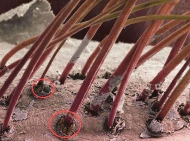 头皮又痒又油,一抓一盖泥,竟是这货在"作怪",快用1方法铲除