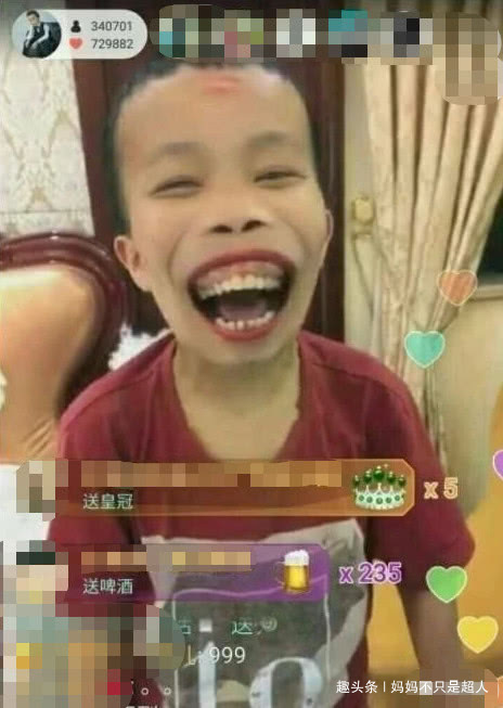 网红外星人陈山出意外,被紧急送医治疗,发文自嘲成了木乃伊!|外星人|