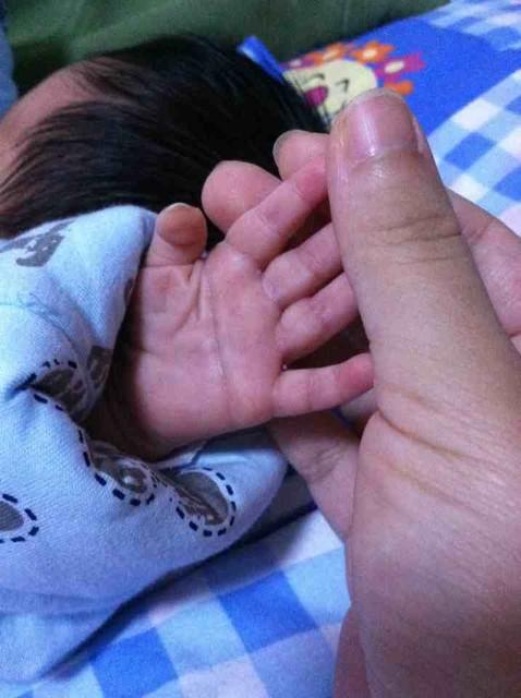 宝宝出生时是断掌,先天心脏病,医生劝放弃,妈妈决定很霸气!