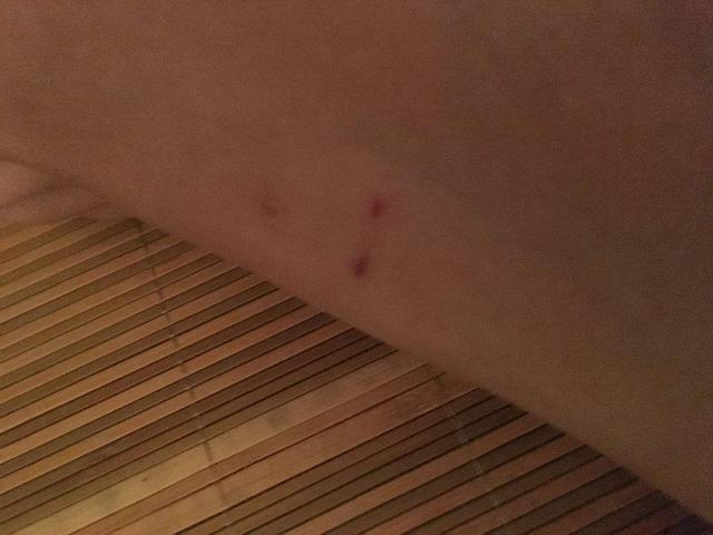 捡回一只流浪泰迪,不到三天连咬2人,这狗还能要?