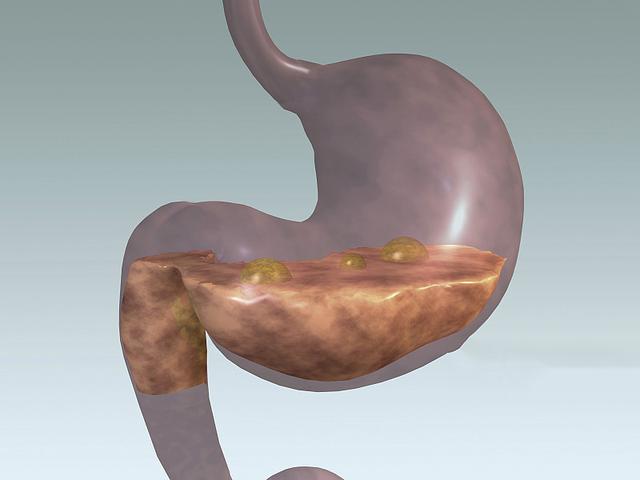 所以要谨记这3喝,2不喝,这样不仅能保护胃部健康,还利于人体养生