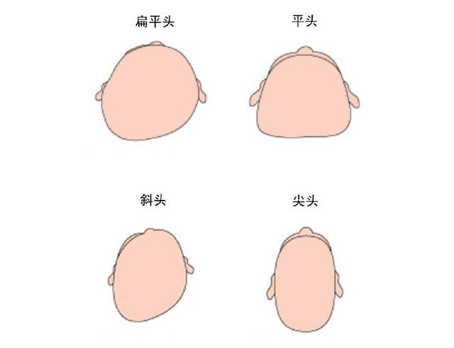 严重的还会造成斜头,尖头,平头,扁平头等,不仅影响形象,长大以后还会