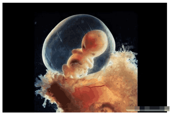 胎心:胎儿的心脏在全身发育中,是最早有功能的器官.