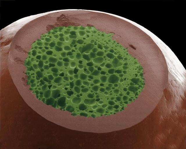 这些在电子显微镜下的食物好怪异