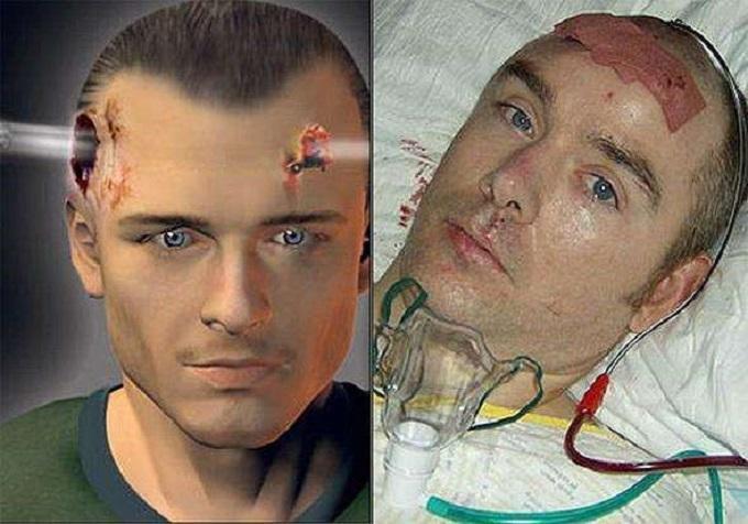 战场上就算子弹不击中重要部位也死亡,为什么?失血过多反应过大