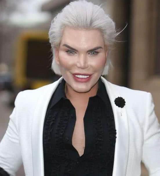 巴西整容狂魔为变成蚂蚁腰,曾花24万摘除肋骨,号称自己很帅