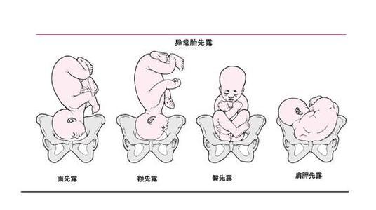 也就是七个月的时候定胎位,因为在孕早期和孕中期时,因为胎儿个子还小