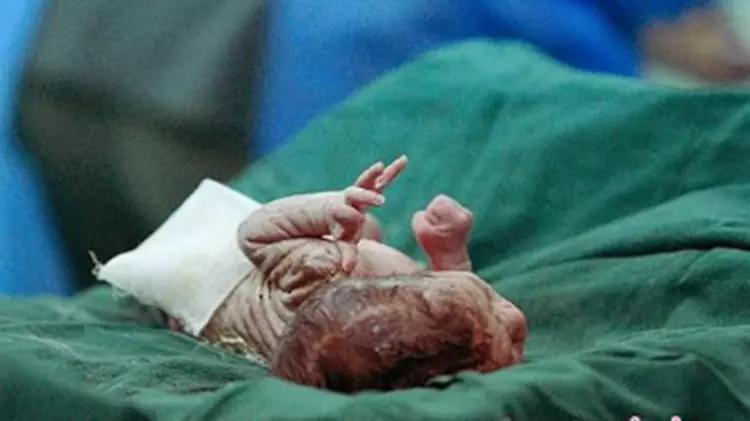 婚后六年怀孕,医生让打掉宝妈不舍,婴儿出生后一家泪目