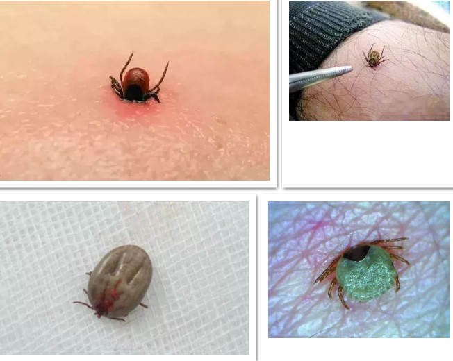 家长们 带娃出去野外警惕这种虫!曾致人死亡!