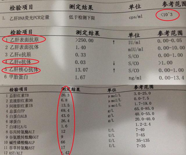 135阳性是大三阳,145阳性是小三阳,13阳性是大二阳,15阳性是小二阳.