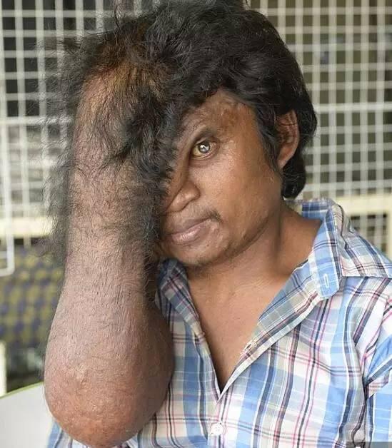 澳洲夫妇出国旅游看到一个极丑无比的男人,于是他们开始了一场