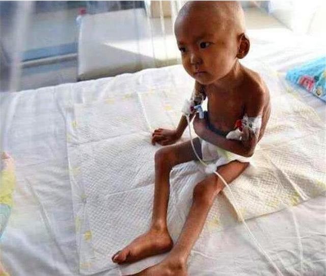 5岁儿子瘦成19斤,孩子想吃东西却被父亲阻止,母亲也很无奈