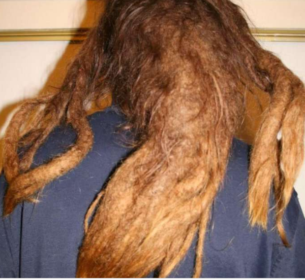 一吹就起鸡皮疙瘩(风一吹鸡皮疙瘩就起来) 一吹就起鸡皮疙瘩(风一吹鸡皮疙瘩就起来)