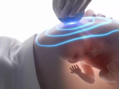 怀孕37周后 胎动有这3个变化是正常的 孕妈不要自己吓自己