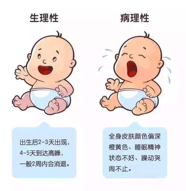 婴儿黄疸图片 对比图片