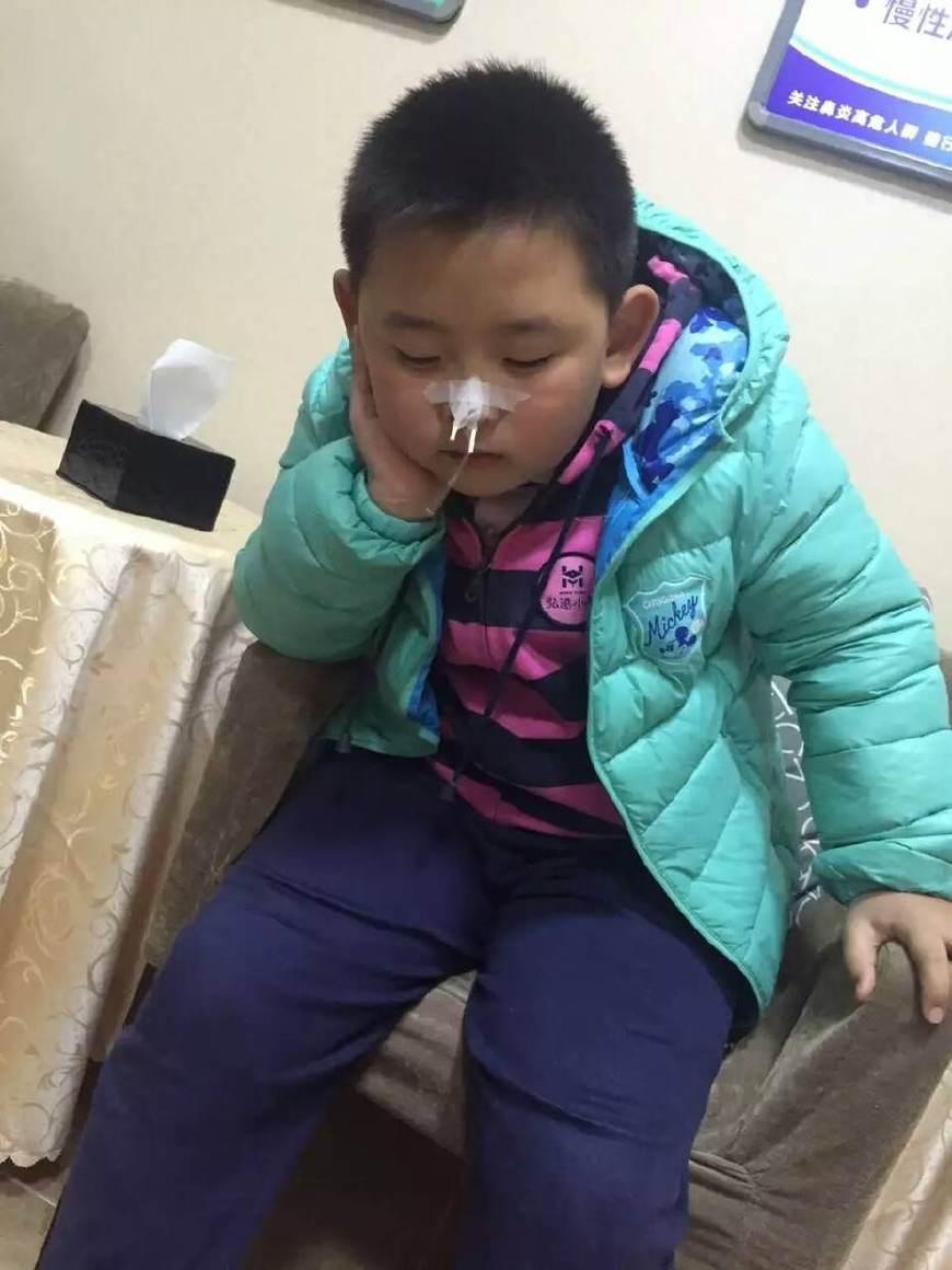 儿子多年鼻炎被不起眼的蝉蜕治好了简单有效