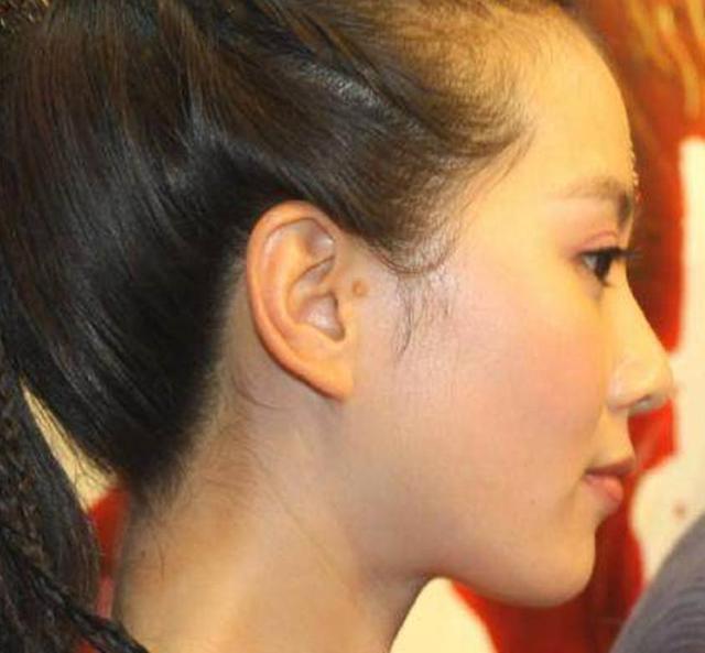 "身体有缺陷"的4位明星,刘诗诗多一只"耳朵",她没有肚脐眼