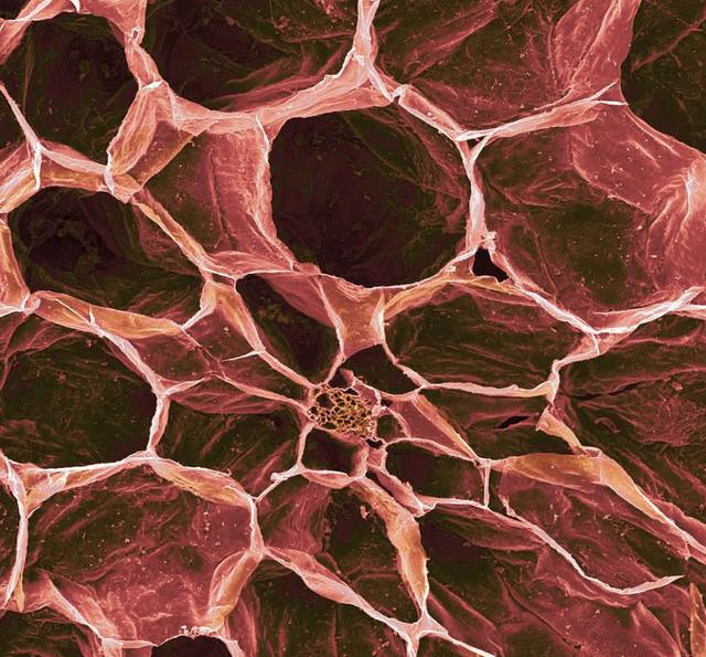 草莓,生肉,西兰花,番茄!这些在电子显微镜下的食物好怪异