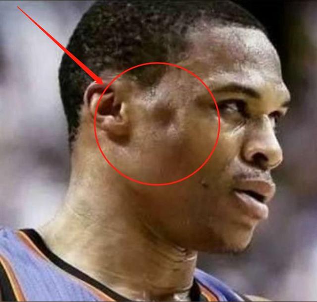 nba级别的对抗赛场上被打到脸变形哈登脑震荡