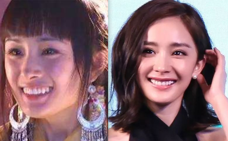 同样做过牙齿整形杨幂和baby美上天唯独她的颜值一落千丈