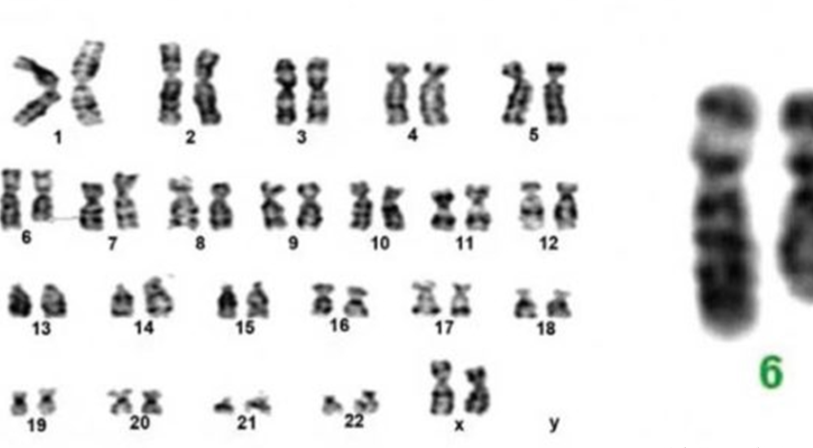 浑厚!8号染色体缺失"不计其数"-第2张图片-星空博客