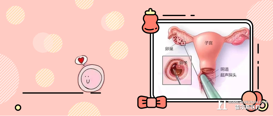 男人们进来看看|试管婴儿|排卵|卵泡_新浪新闻