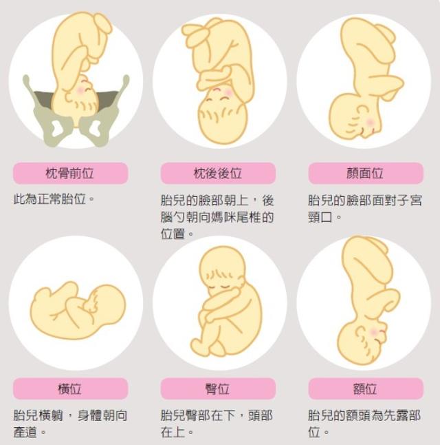 顺产|剖腹产|胎儿_新浪新闻