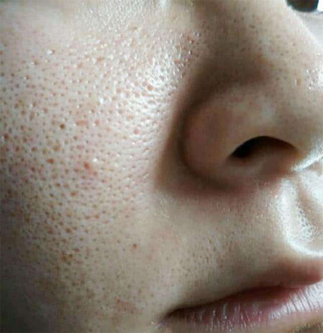 洗脸能清理毛孔脏东西吗