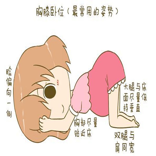 33周之前一直是头位33w4去查又成臀位宝宝还可能自己转头吗