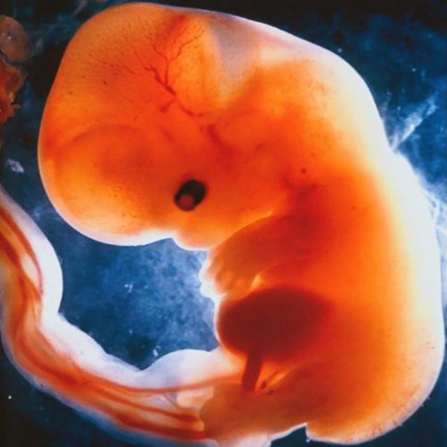 胚胎胎芽图片欣赏图片