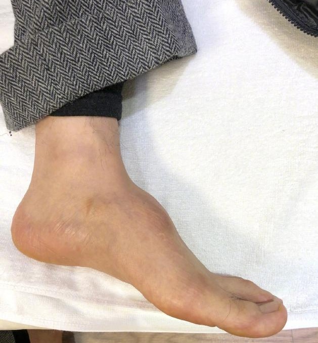 黄晓明首次正式回应鞋垫质疑直接晒出光脚照片网友心疼