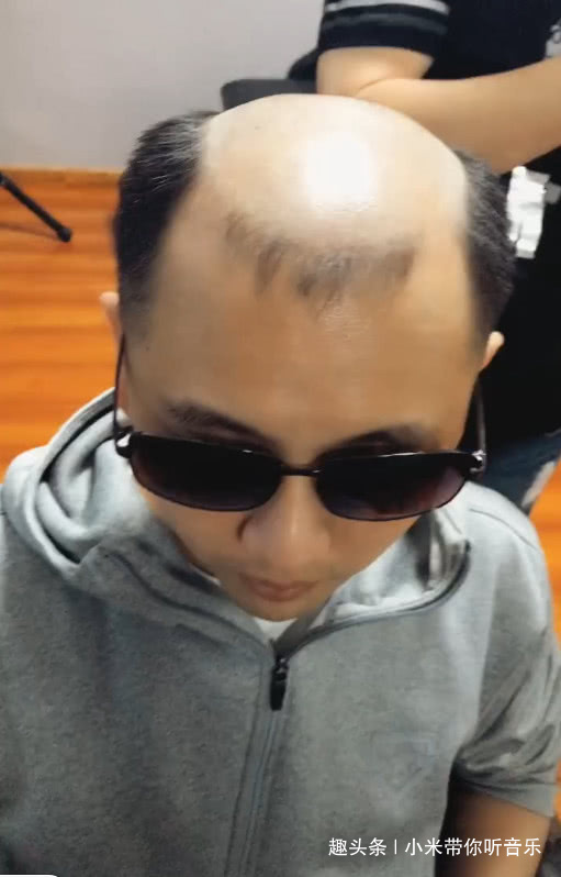 富二代因"秃头"烦恼,造型师的一步操作后,大叔秒变小鲜肉