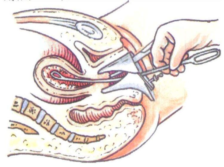 产科医生:超过这个次数,以后就怀不上了
