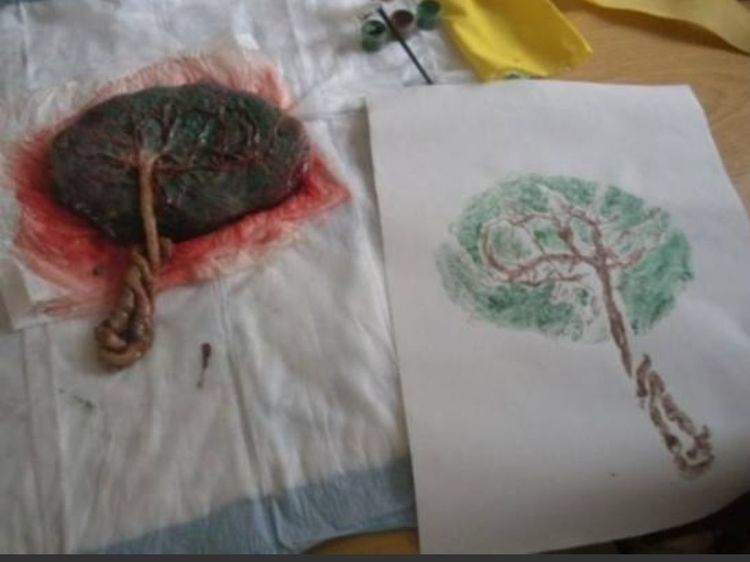 孕妇分娩时,胎盘也会随之脱落,那排出来的胎盘最后会怎样处理呢