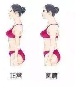 女生怎样避免比较发达的斜方肌?