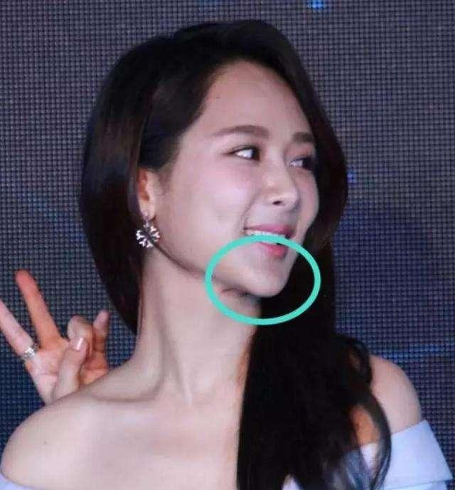 整容以后下巴吓死人的明星,竟然以马思纯舒畅杨紫为首?