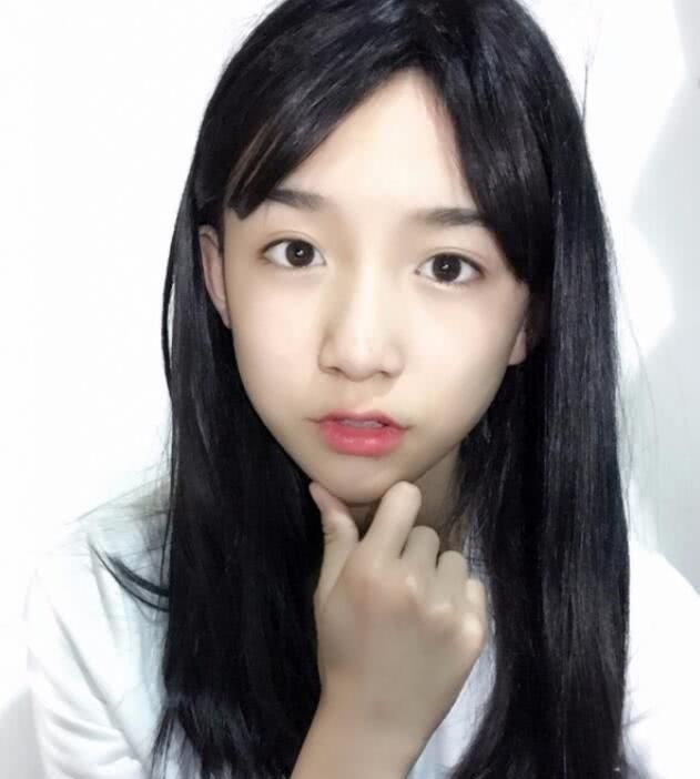 14岁网红abbily整容前后照片曝光 网友:玻尿酸不要钱吗