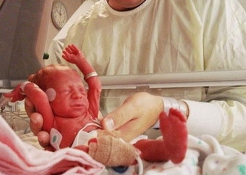 印度一女子产下11胞胎 创世界纪录 ----真的假的!