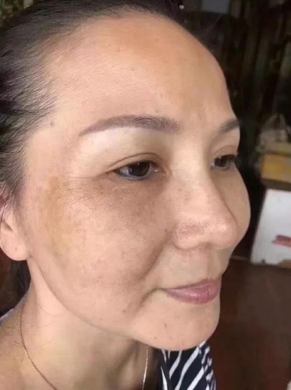 药房买点维生素e回家加上它敷脸,一周脸上斑点不见皮肤白嫩光滑