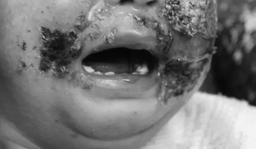 6个月宝宝脸被"捏烂",谁再这样捏我宝宝,我就跟他断交|宝宝|口水|脸蛋