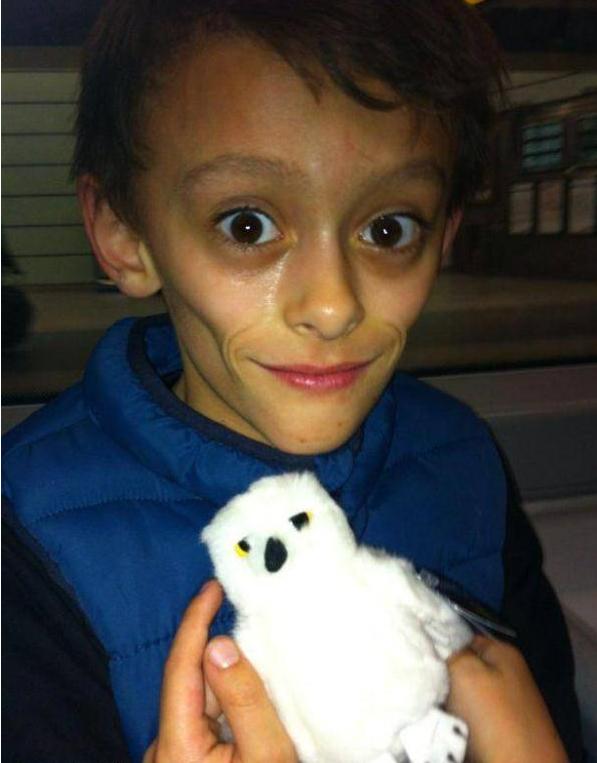 11岁男孩瘦骨嶙峋两颊凹陷,像70岁老人,被称"外星人"