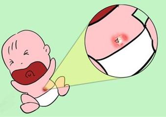 0到1岁婴儿护理要点和注意事项整理了很久需要的收藏