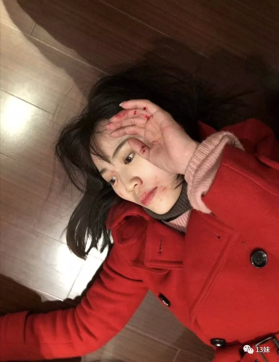 马蓉被打撕嘴巴送医院急诊脸部手部有明显瘀痕