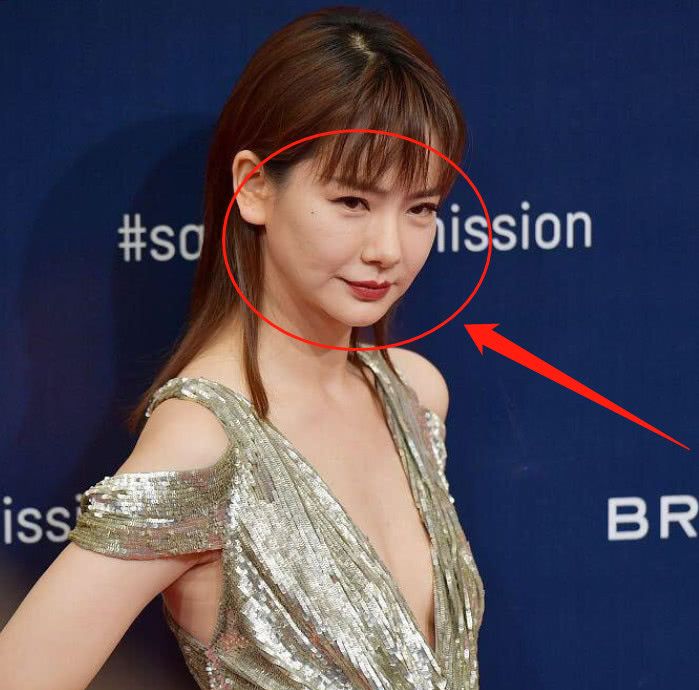 欢快!戚薇整形"眉开眼笑"-第1张图片-老周博客