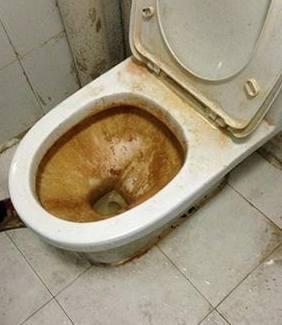 为什么马桶怎么擦都脏用这个办法洗完和新的一样